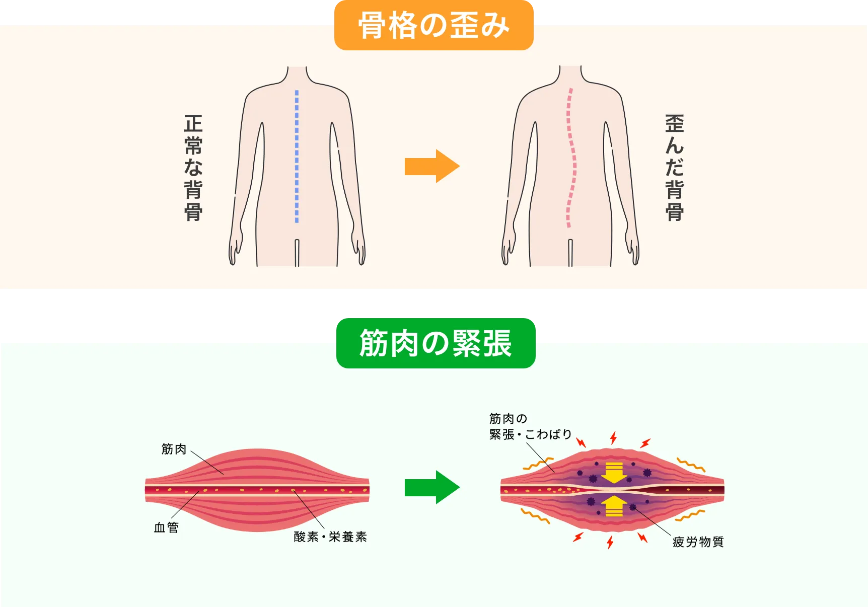 肩こりの原因